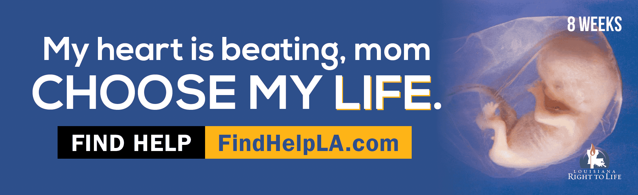 Southwest Louisiana pro-life billboard campaign image